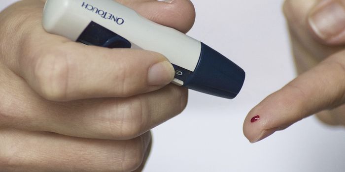 Stem Cell Implant Device may Functionally Cure Diabetes Type I