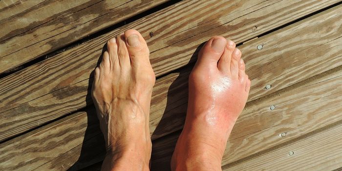 Tissue Stiffness Regulates Immune Responses