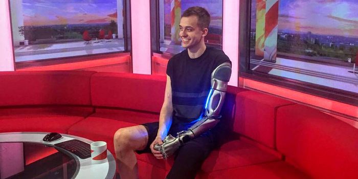 This Amputee and Video Game Player Has a Sick-Looking Bionic Arm