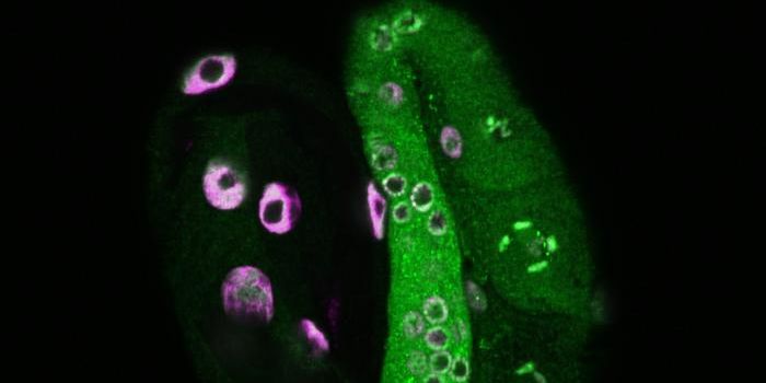 How Lysosomes Can Make Longevity Heritable
