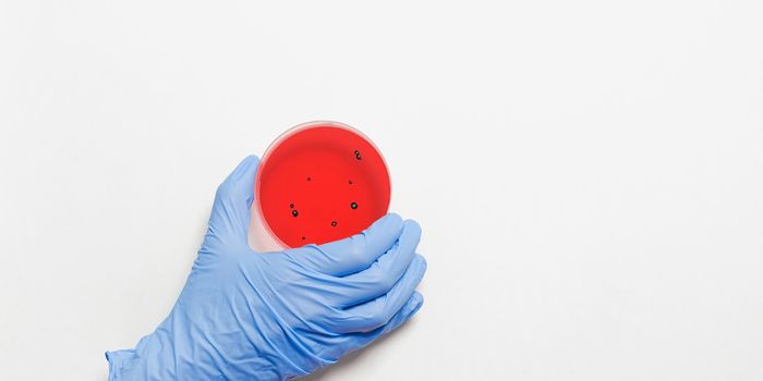AI Platform Finds Superbugs Faster