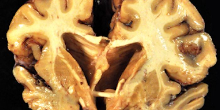 Understanding the Molecular Impact of Blunt Force Trauma