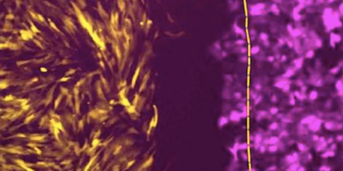 When a Cancer Gene Switches Sides