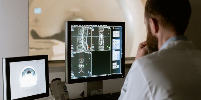 Advanced Imaging Could Help with Diagnosing and Treating Prostate Cancer