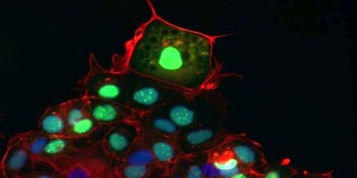 Cells Follow the Leader to Heal Wounds