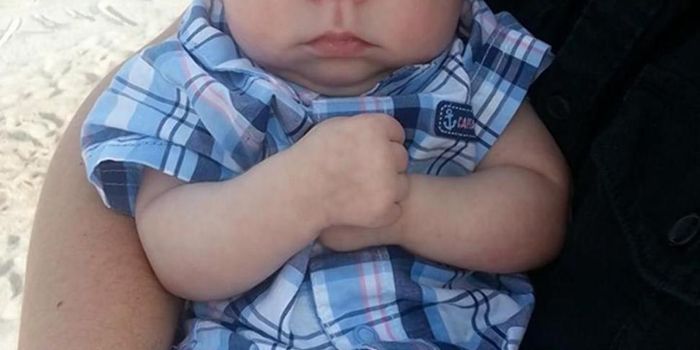 Baby Missing Most of His Skull and Brain Celebrates 1st Birthday