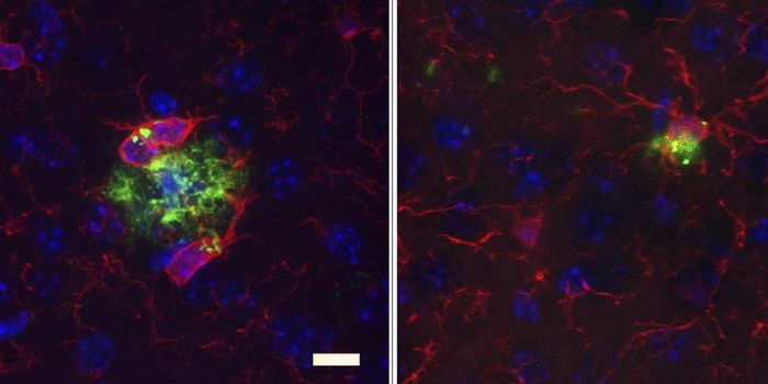 Altering the Gut Microbiome Relieves Alzheimer's Symptoms in Mice