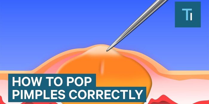 You're Probably Popping Your Pimples Wrong