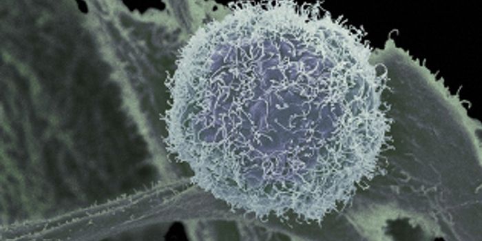 An Answer for Cervical Cancer