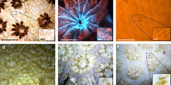 Underwater Microscope Connects the Lab to the Natural World