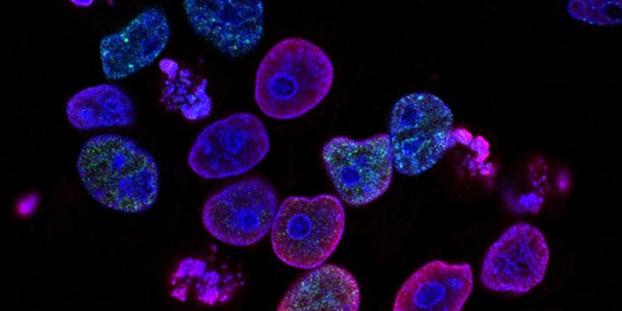 Investigating Cancer's Metabolism for a New Drug Target