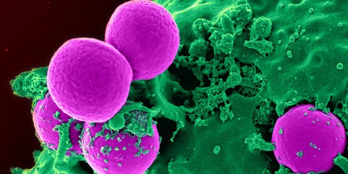 The Unseen Barriers Surrounding Pancreatic Cancer