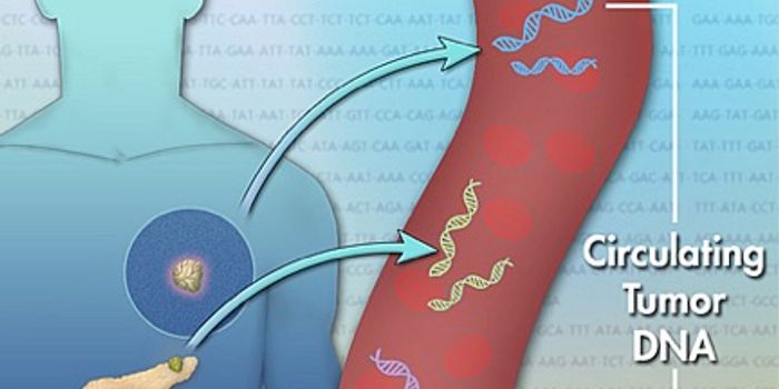 New Blood Test Detects Melanoma's Spread