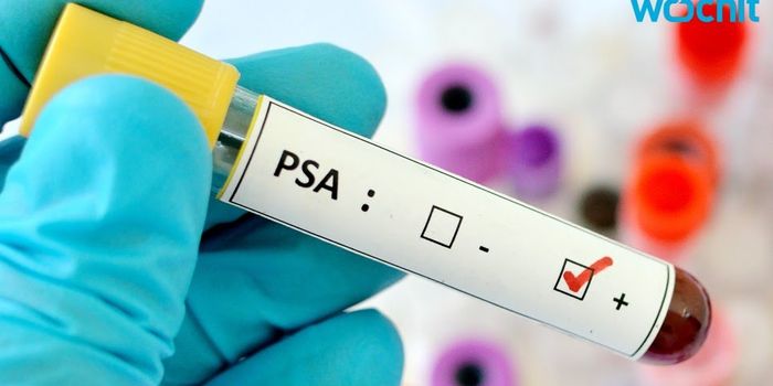 Aggressive Prostate Cancer Cases on Rise, But Still Unlikely To Spread