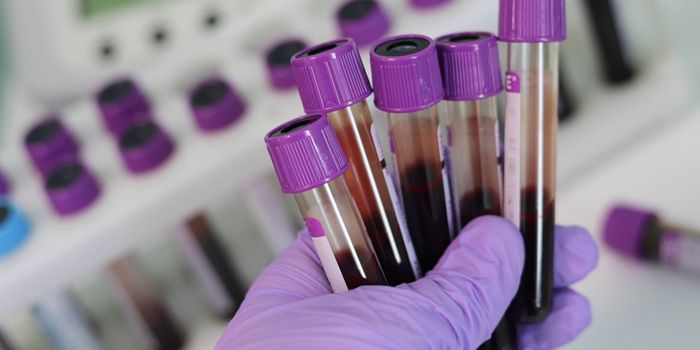 Biomarkers Can Identify Dementia 15 Years Before Onset