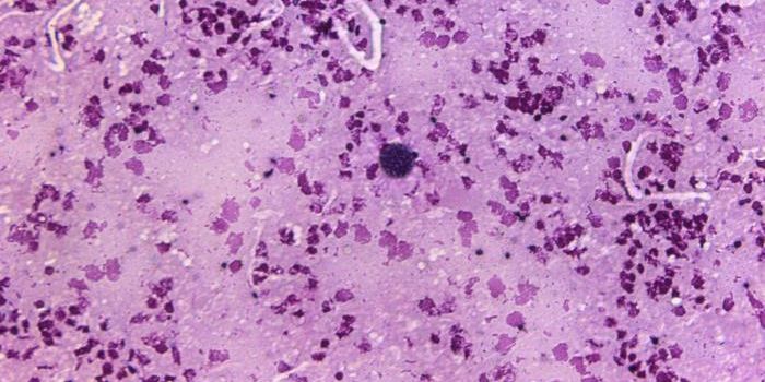 Mitochondria Can Help Defend Cells Against Infection