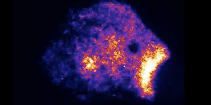 A Model of Spinal Development Provides Insight Into Disease