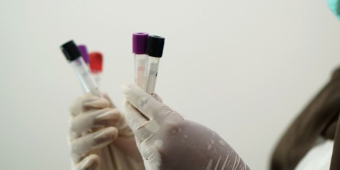 Patient Error Renders Many Home Colon Cancer Tests Unusable