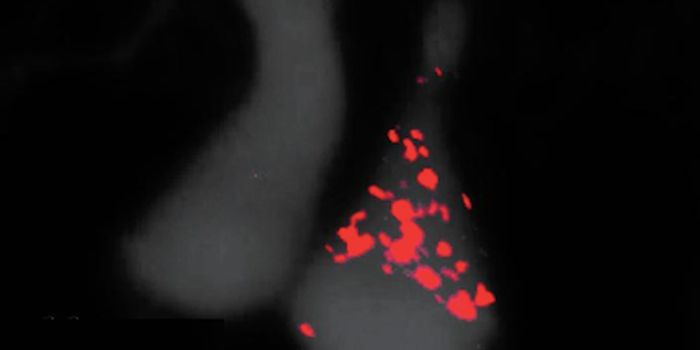 Gene Found to Help Prevent Brain Disease