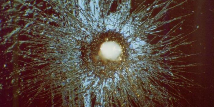 Cavity-Causing Germs Can Form Superorganisms Able to Crawl on Teeth