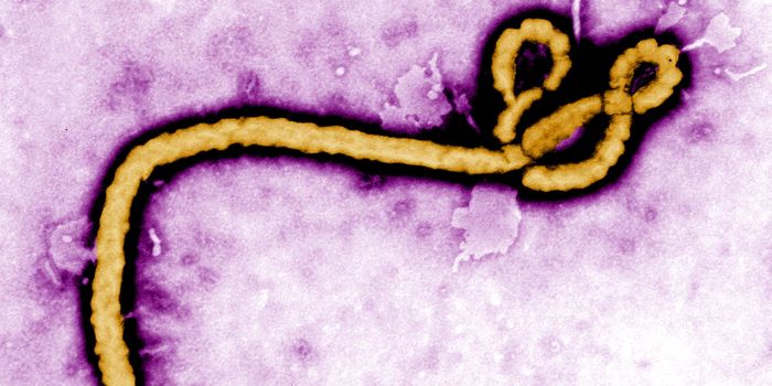 Small Molecules Could be a way to Stop Ebola