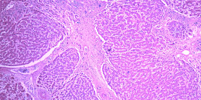 No Antibiotics? No Problem.