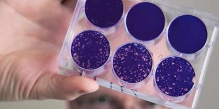 Small Molecules Found to Dial Down Autoimmunity