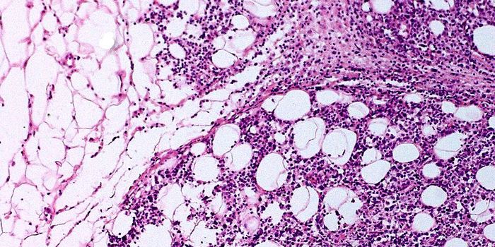 New Cancer Drug Approach Avoids Friendly Fire in the Immune System