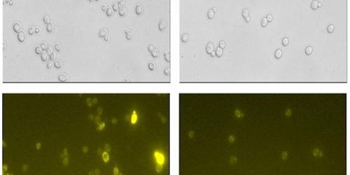 Using Yeast to Synthesize Incredible new Drugs