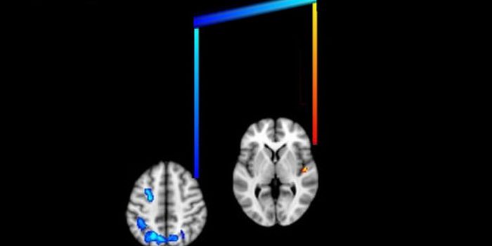 Reaching the Brain With Music