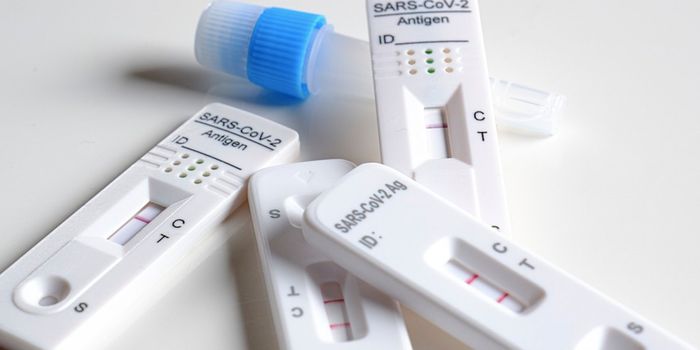 Advances in COVID-19 Diagnostics