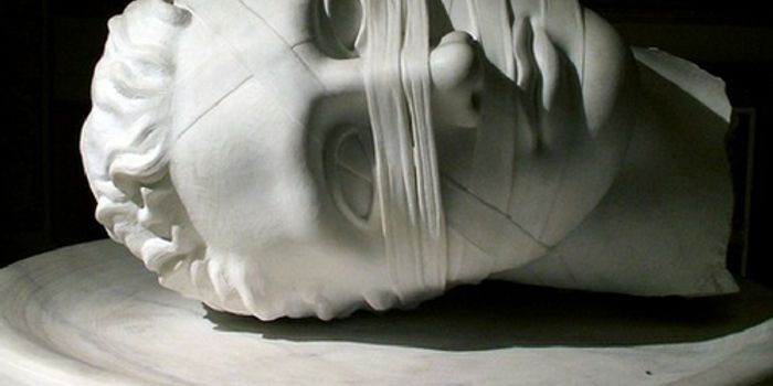 Migraine Surgery Yields Results For Many Patients