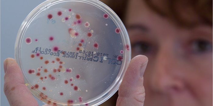 Lupus Flares are Connected to a Gut Microbe