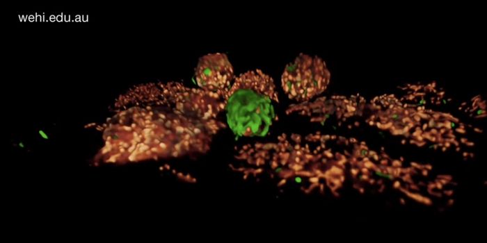 To Outsmart Salmonella, Cells Can Commit Suicide in Different Ways