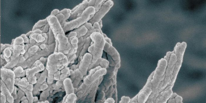 Scientists Discover Why Arteries Harden & Find a Potential Treatment