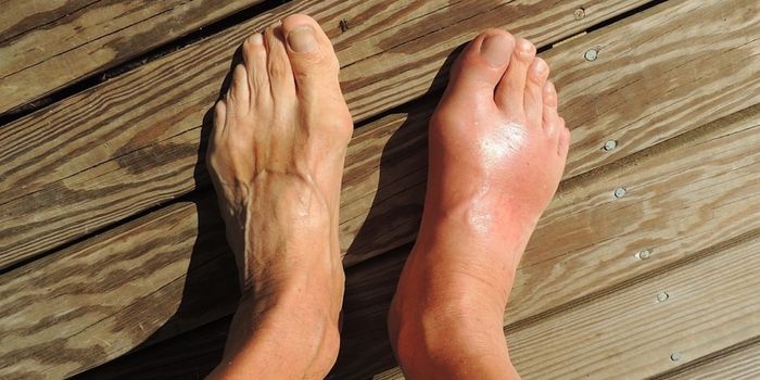 Getting Rid of Damaged Mitochondria Relieves Autoimmune Disease in Mice