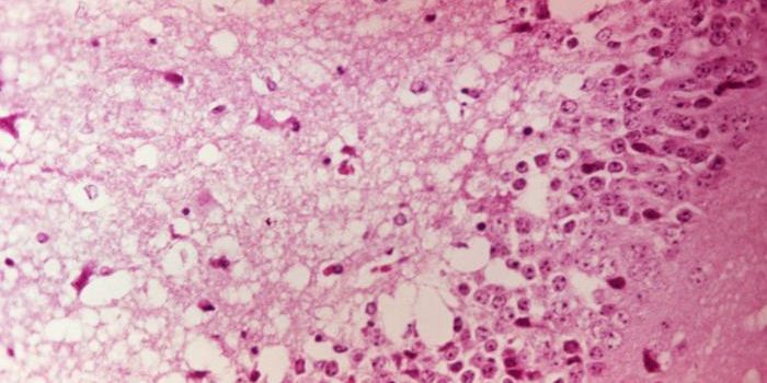 By Exploiting a Weakness in Genetic Code,  RNA Virus is Attenuated