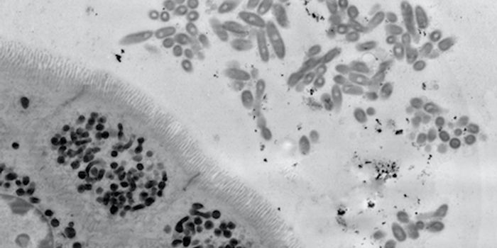 Understanding how the Microbiome is Built