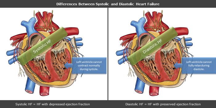 Exercise and Diet Interventions to Get Obese People Up and About