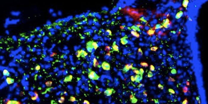 Hypothalamic Neurons in the Obese are Different