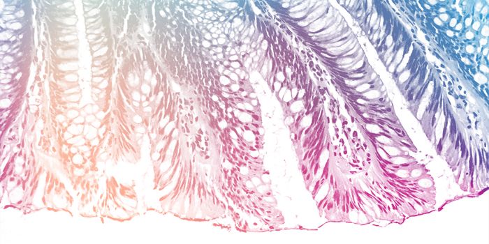 Learn How Spatial Biology Can Advance Your Research