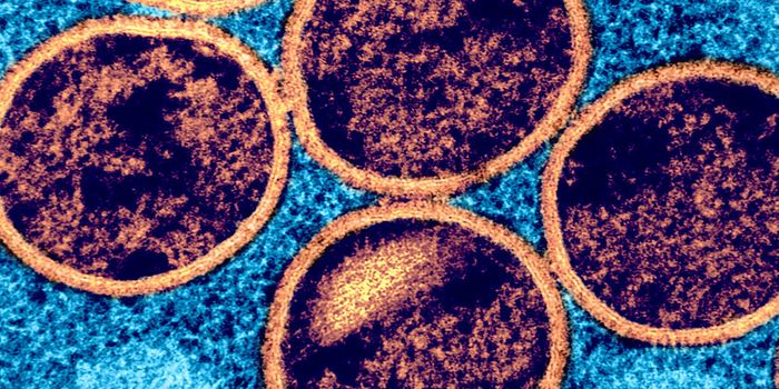 Scientists Monitor the Concerning Spread & Evolution of Mpox