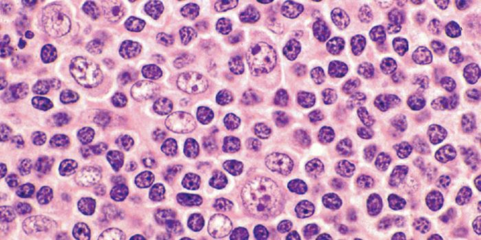 Metabolism and Metastasis