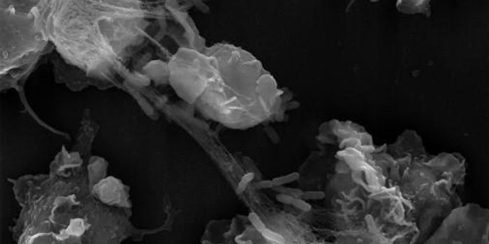 "Beneficial Cell Suicide" Fights Pathogens in the Bloodstream