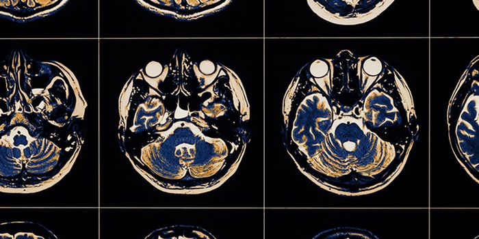 New Drug Target for Chemically-Induced Parkinson Disease