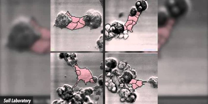 How Cells Become Tumors