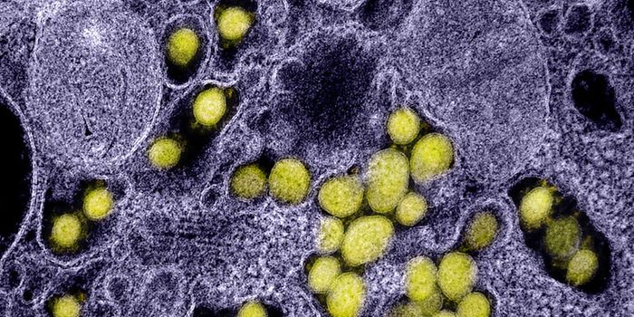 Rapid, Efficient COVID-19 Diagnostic Method Relies on Magnetic Beads