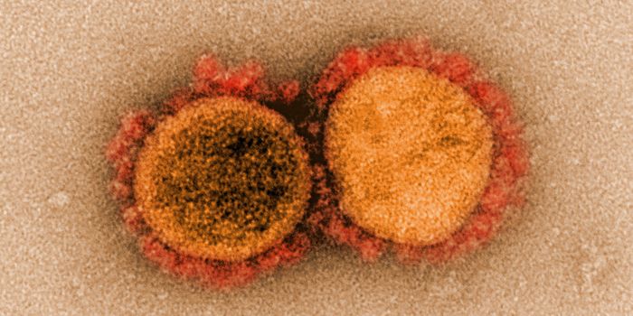 COVID-19 Attacks Endothelial Cells