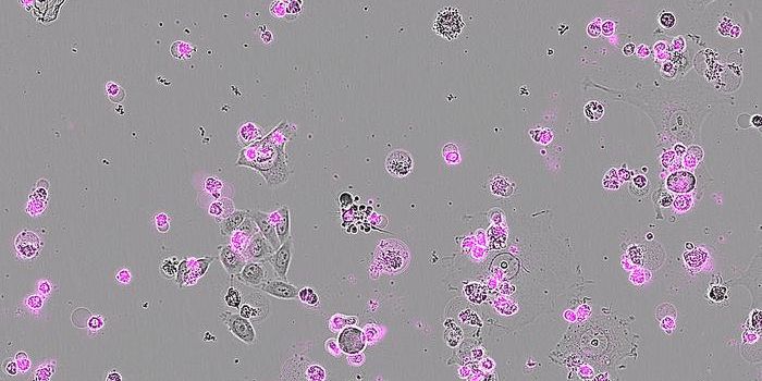Novel CRISPR Technique Aims to Destroy Virus-Infected Cells