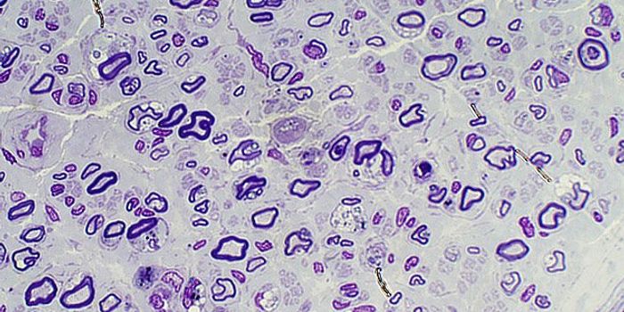 Crucial Gene Discovery